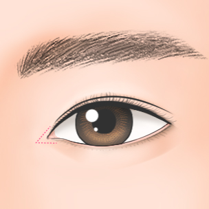 step1