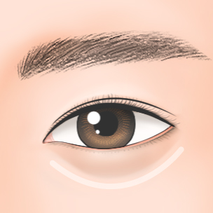 step1