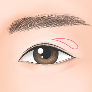 step1