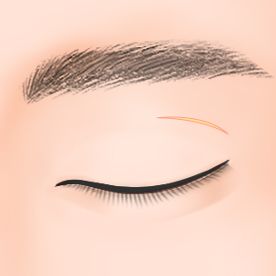 step3